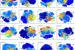 Multiplexed 3D atlas of state transitions and immune interactions in colorectal cancer.